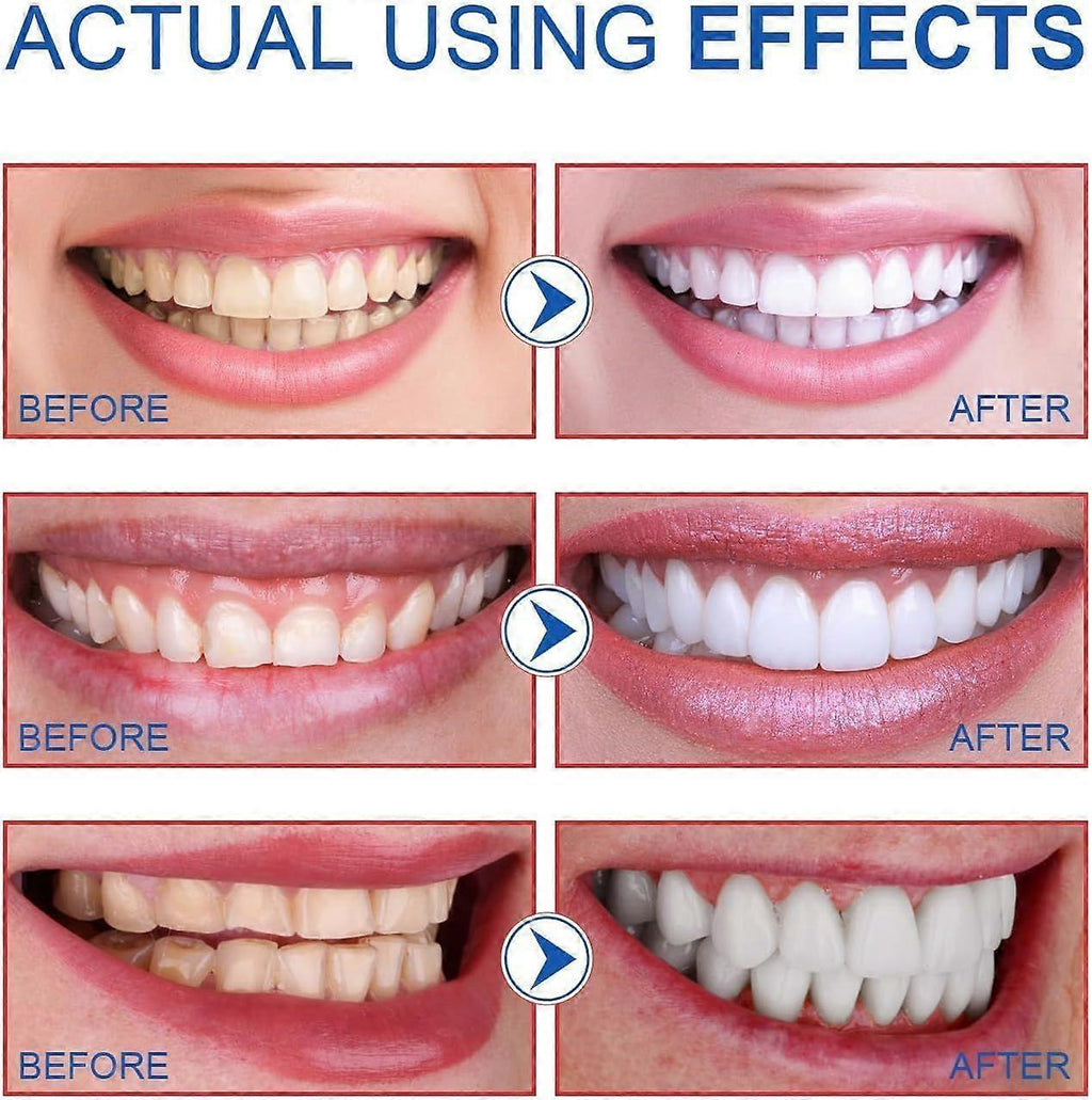 SP-6 Probiotic Whitening Toothpaste